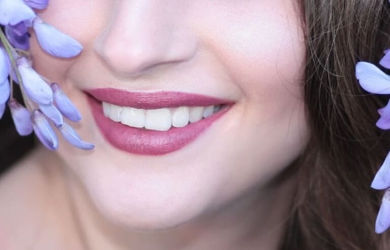 Come mantenere i denti bianchi dopo lo sbiancamento