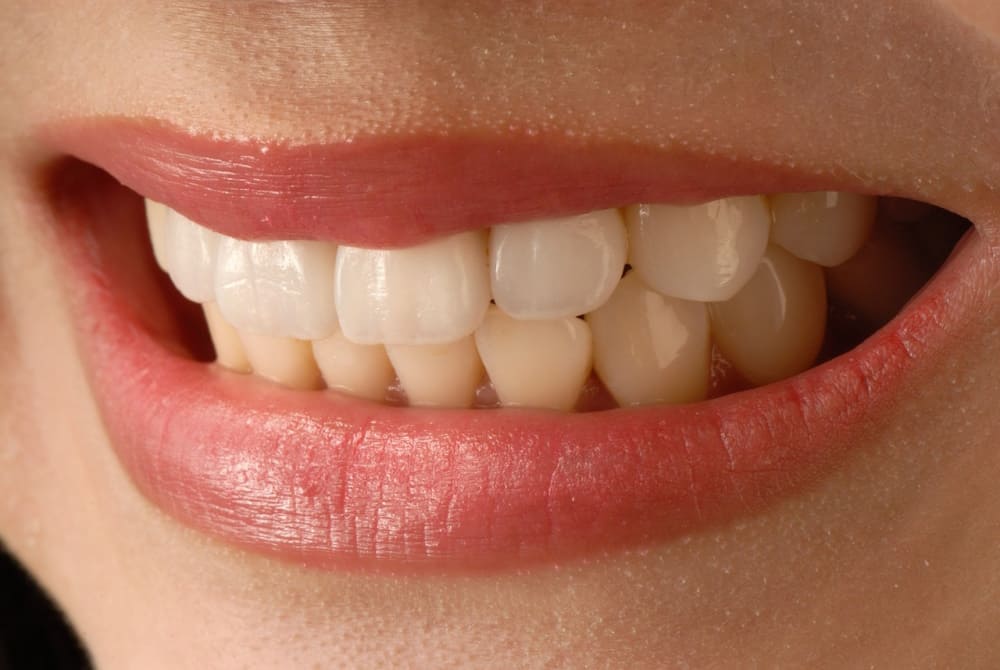 Denti macchiati cause e rimedi