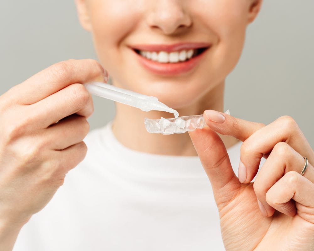 Sbiancamento denti con mascherina come funziona